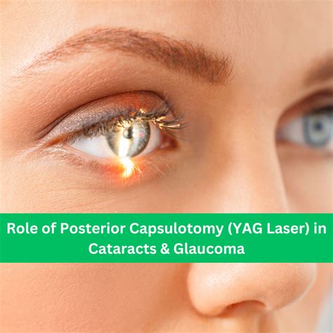 YAG laser capsulotomy Specialists in Huddersfield .
